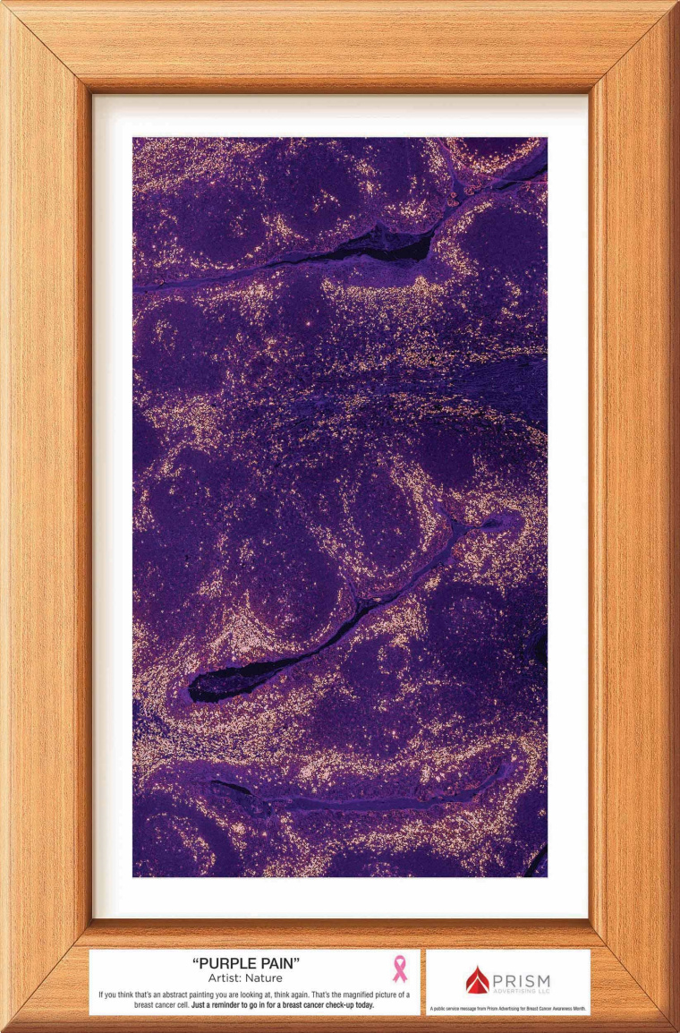 廣告公司為乳腺癌體檢檢測公益宣傳月設(shè)計的抽象藝術(shù)風(fēng)創(chuàng)意海報賞析-紫色的痛苦