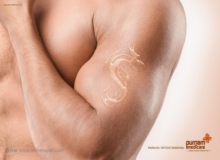 “紋身 - 龍”篇無痛紋身去除醫(yī)療服務(wù)平面創(chuàng)意廣告設(shè)計(jì)-上海設(shè)計(jì)公司 “紋身 - 龍”篇無痛紋身去除醫(yī)療服務(wù)平面創(chuàng)意廣告設(shè)計(jì)-上海設(shè)計(jì)公司