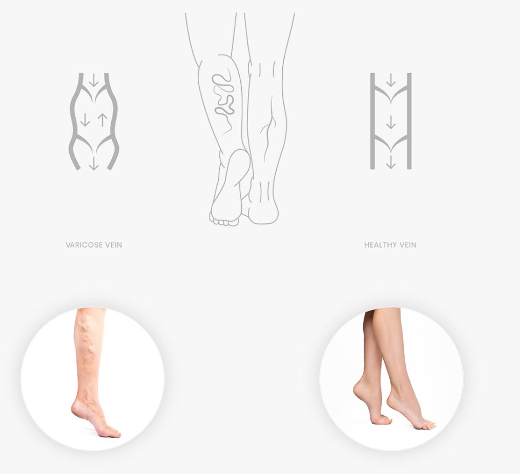 ViH血管醫(yī)學(xué)私人診所品牌識(shí)別logo設(shè)計(jì)，皇家深藍(lán)色和玫瑰色膚色